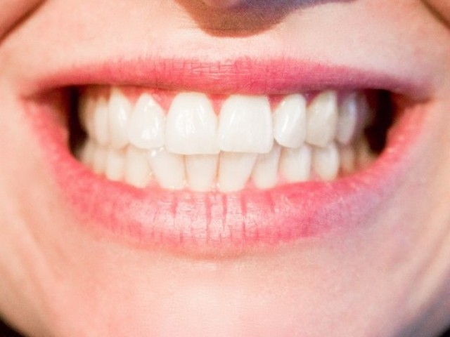 18 цікавих фактів про зуби