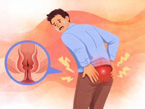 Анальна тріщина: причини появи та ефективне лікування